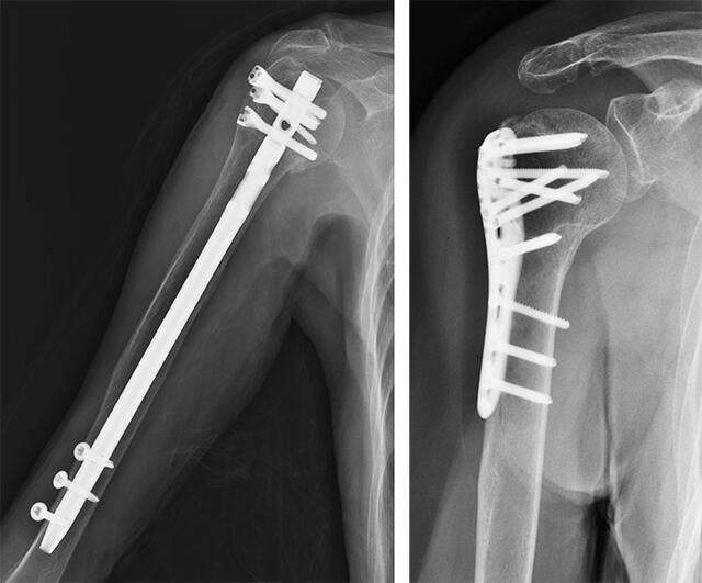 何が原因でしょうか?