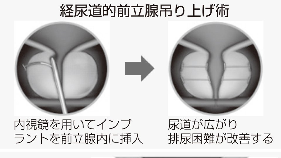 併用療法と別の選択肢