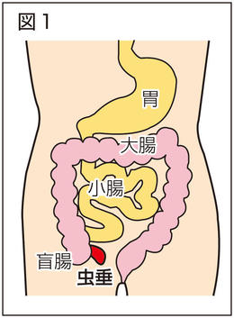 急性虫垂炎 岐阜新聞web