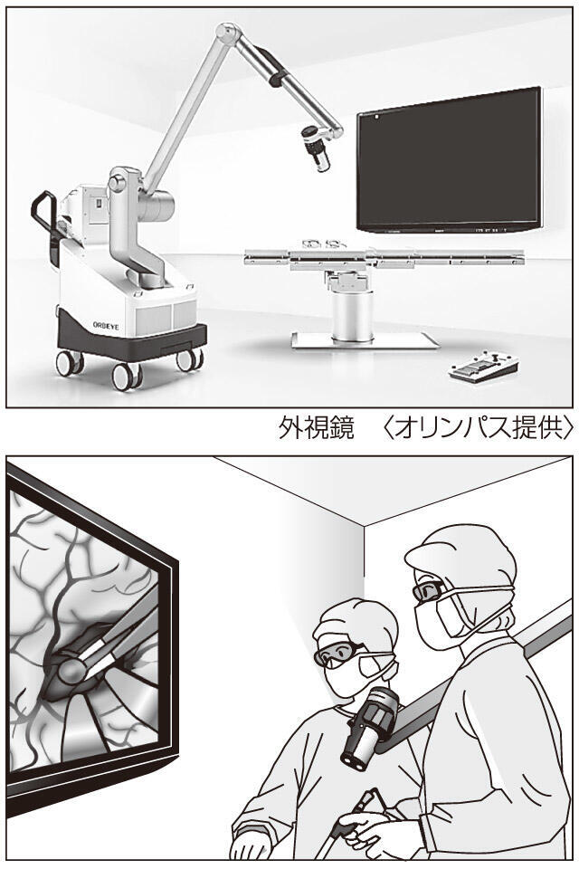 開頭手術その12 | 岐阜新聞デジタル