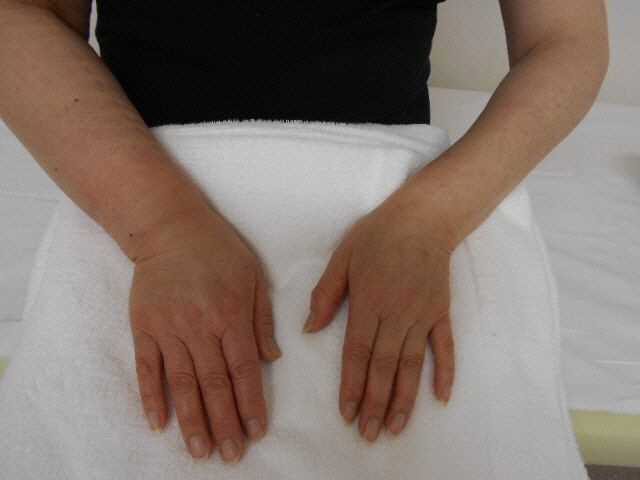 腋窩リンパ節症と新型コロナウイルスワクチンについて知っておくべきこと