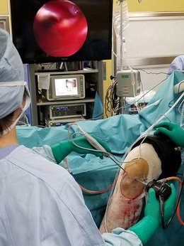 整形外科の内視鏡手術 | 岐阜新聞Web