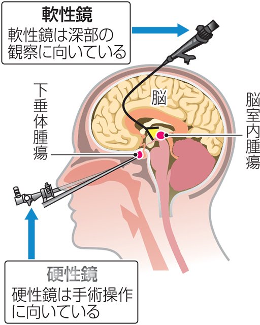 開頭手術 その11 | 岐阜新聞デジタル