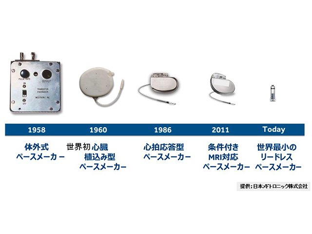 進化するペースメーカー | 岐阜新聞Web